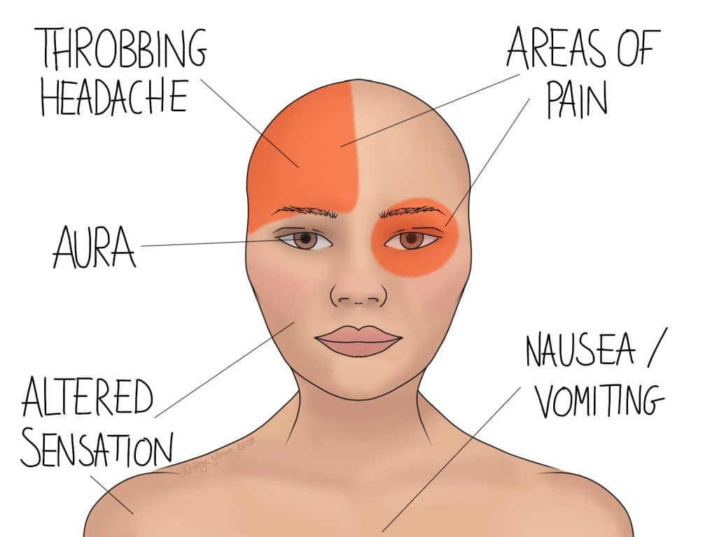 Natural Migraine Remedies Natural Migraine Remedies